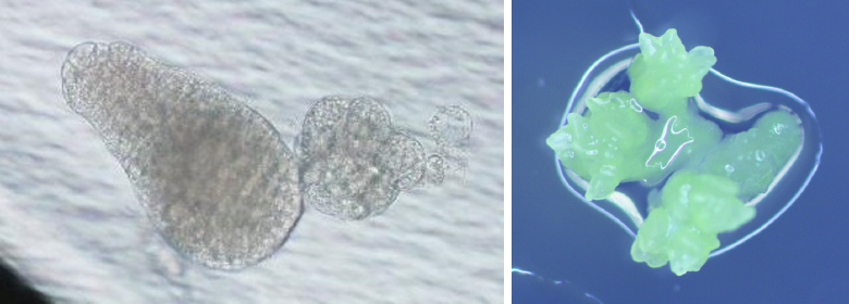 図　トウモロコシ単離受精卵由来の胚様体（左）と分化中の培養体（右）。